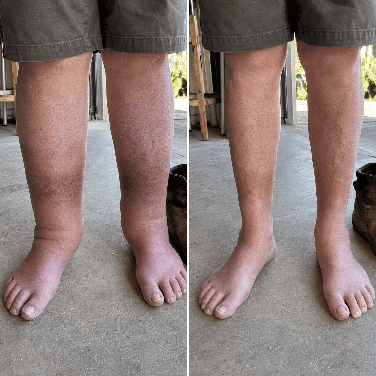Frank, antes e depois